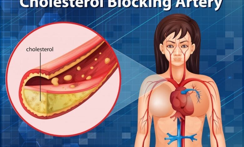 cholesterolio vizualizacija